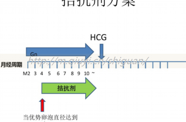 国内哪个医院做试管婴儿